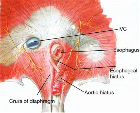 Esophageal hiatus – Anatomy, Location, Function, Hernia and Pictures - Bodterms