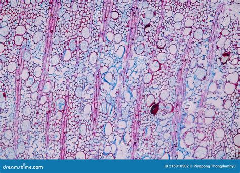 Fungi Living in Wood As a Group, are Polyphyletic Under the Microscope ...