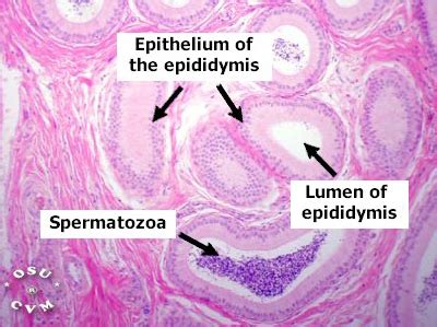 Epididymis Histology - Epididymis, cat (labels) - histology slide