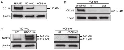 CD146 expression in large cell neuroendocrine carcinoma cells and the... | Download Scientific ...