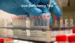 Iron Deficiency Test : Procedure, Iron Deficiency Causes and Symptoms