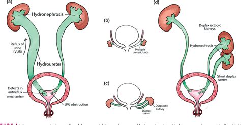 Figure 4 from Lower urinary tract development and disease. | Semantic Scholar