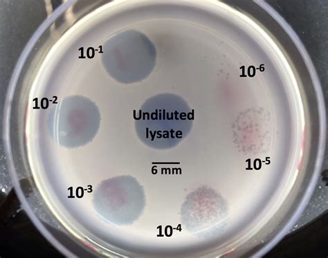 RRResearch: Phage plaqueing still sucks - what to do now?