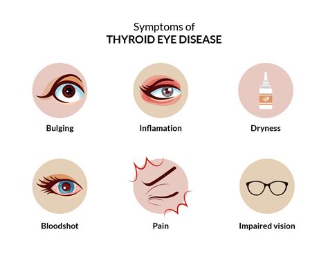 What is Thyroid Eye Disease? | SmartBuyGlasses US