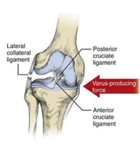 3 Exercises To Strengthen And Protect Your Knees — California Strength