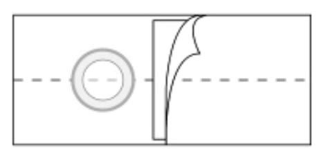 Nu-Form Peristomal Hernia Belt by Nu-Hope Labs