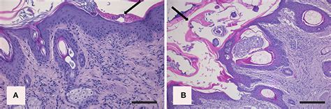 Frontiers | Sarcoptic Mange in Wild Caprinae of the Alps: Could Pathology Help in Filling the ...