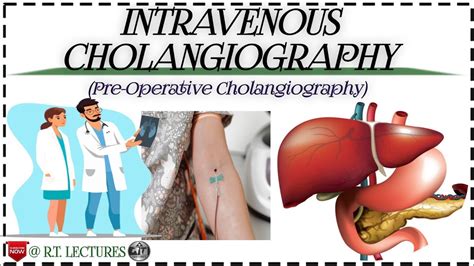 #Intravenous Cholangiography #Pre-Operative Cholangiography #IVC #Hepatobiliary system ...