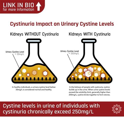 Pin on Cystine Kidney Stones (Cystinuria)