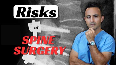 RISKS of spine surgery - YouTube