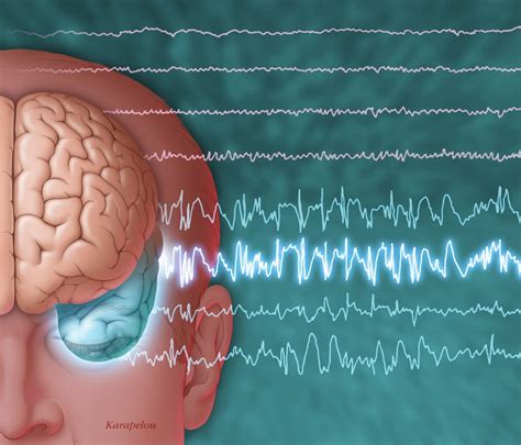 Early Seizures Following Traumatic Brain Injury Tied to Poor Outcomes - Neurology Advisor