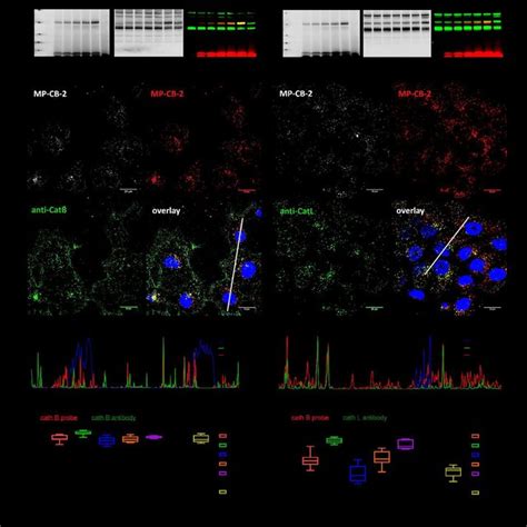 Cathepsin B detection in lysosomes of cancer cells. Cy5 MP-CB-2 probe ...