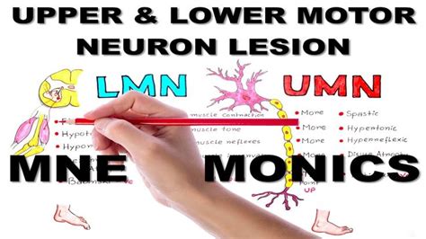 Upper & Lower Motor Neuron Lesions / Mnemonic series #5 | Neurons, Medical school studying ...