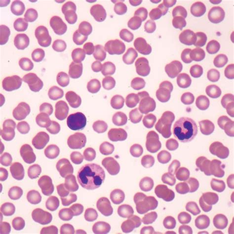 Analysis Of Red Blood Cells From Peripheral Blood Smear, 40% OFF