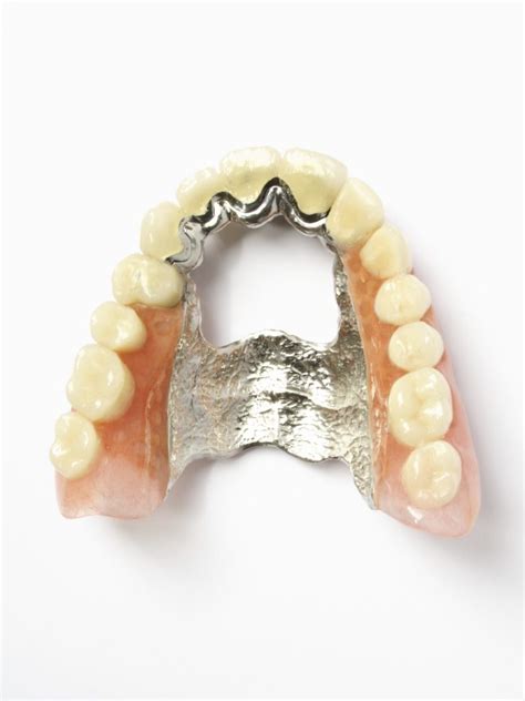 Metal dentures available in Kingston, London everyday 9am-10pm.