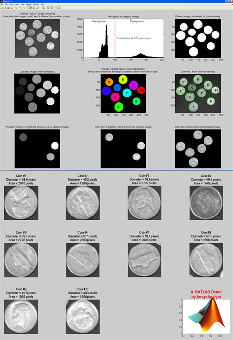 MATLAB Image Segmentation Tutorial | BIII