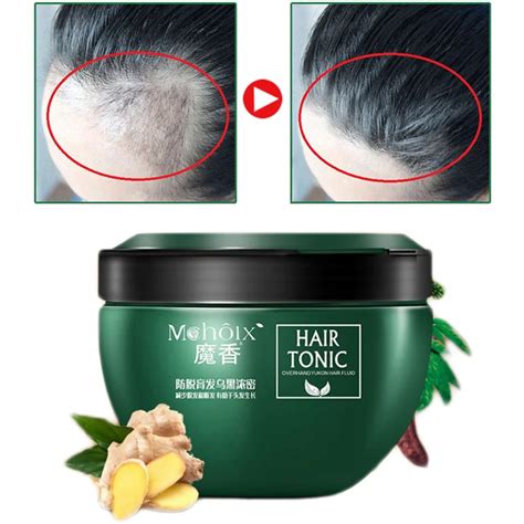 Good quality Men Women Hair Loss Treatment Hair Regrowth Treatment ...