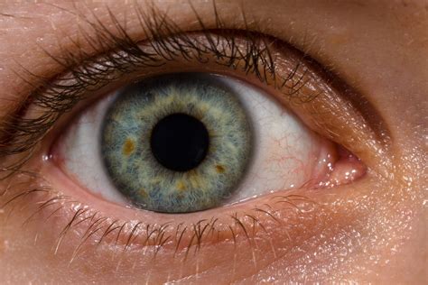 File:Human eye with blood vessels.jpg - Wikimedia Commons