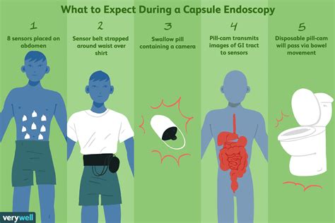 Capsule Endoscopy Belt