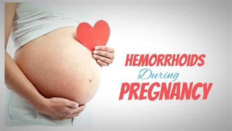 Best Home Remedies for Hemorrhoids During Pregnancy