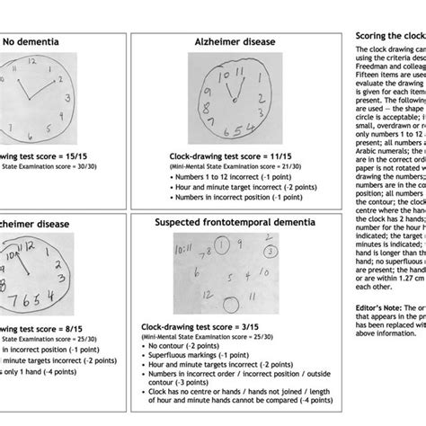 Clock Drawing Test Scoring – Warehouse of Ideas