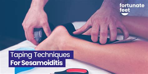 Taping Techniques For Sesamoiditis - Fortunate Feet