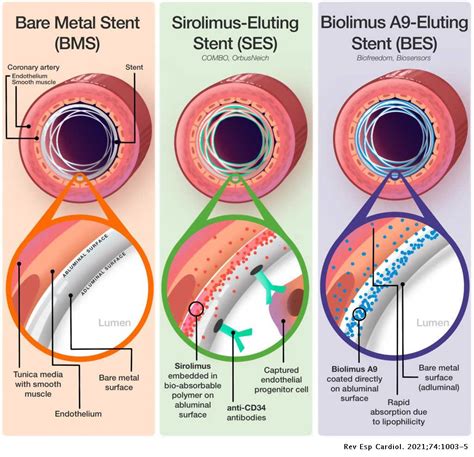 Novel drug-eluting stents to improve coronary endothelial and ...