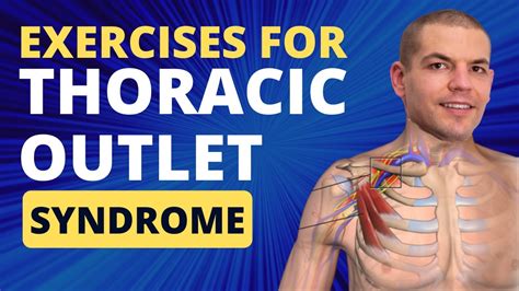 Exercises for Thoracic Outlet Syndrome - YouTube