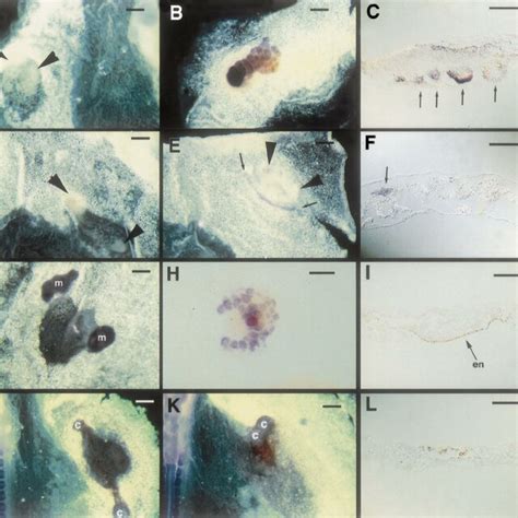 Hensen's node dorsalises ventral mesoderm. A quail stage 5 posterior... | Download Scientific ...