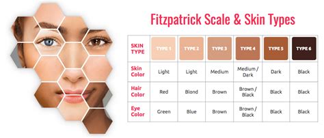 Fitzpatrick Skin Type Chart