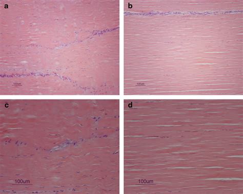 (a, c) Histology of an MSC treated tendon. (b, d) Histology of a normal... | Download Scientific ...