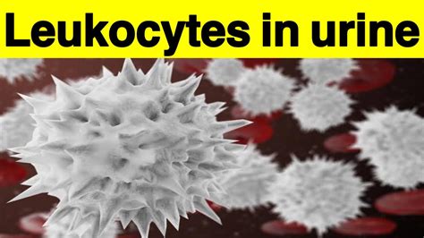 Leukocytes in urine | How to get rid of leukocytes in urine without antibiotics| Leukocytes ...