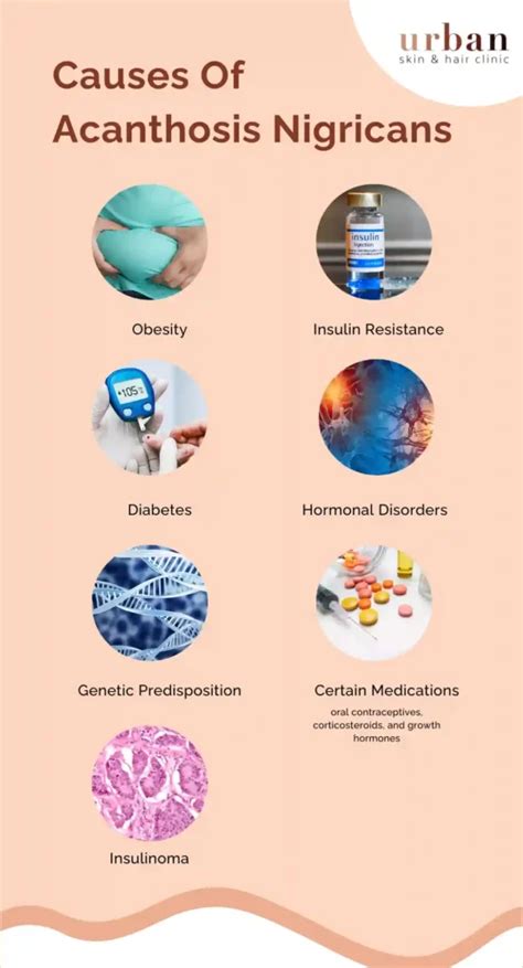 Acanthosis Nigricans Types, Causes, Symptoms & Treatment | USHC