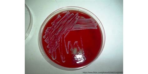 110: Treatment of Coagulase-Negative Staphylococci Infection - Pharmacy Joe