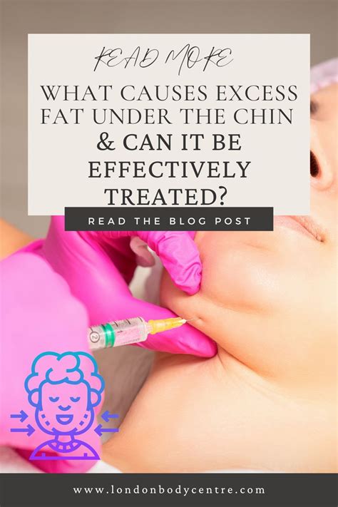 Unmasking the Double Chin: Causes and Effective Treatments