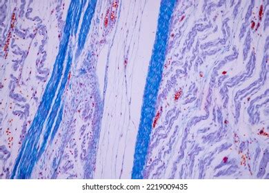 Study Tissue Samples Hyaline Cartilage Elastic Stock Photo 2219009435 ...