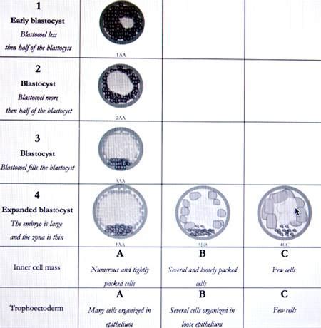 Understanding the Blastocyst Grading Scale | The IVF Process