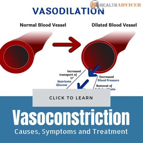 Vasoconstriction: Causes, Picture, Symptoms and Treatment