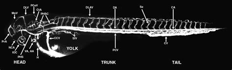 Vascular Anatomy Of The Brain