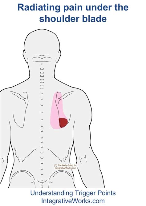 Pain at the Bottom of the Shoulder-Blade | Integrative Works