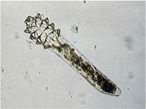 Demodex Mites Inside Nose