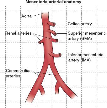 Mesenteric Stenosis Baton Rouge | Mesenteric Stenosis Louisiana