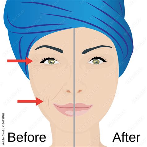 Aging face treatment. Before and after Stock Vector | Adobe Stock