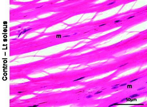 Light microscopic picture of L.S of skeletal muscle fiber of uncrushed... | Download Scientific ...