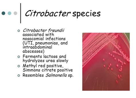 Citrobacter freundii - Characteristics, Symptoms, Treatment