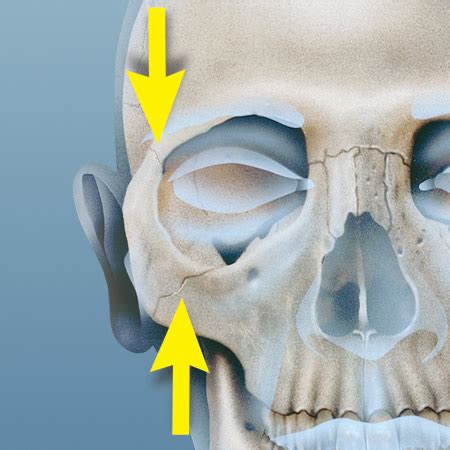 Zygomatic Process