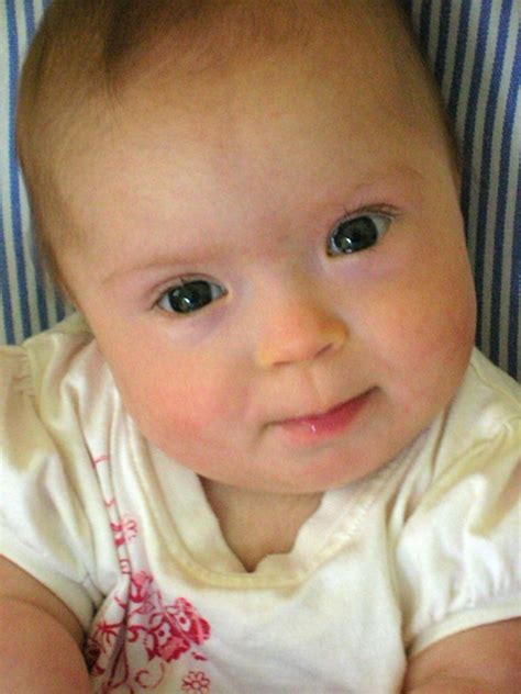 Downs Side Up: What to Say When a Baby is Born with Down's Syndrome