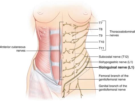 Iliohypogastric Nerve Distribution