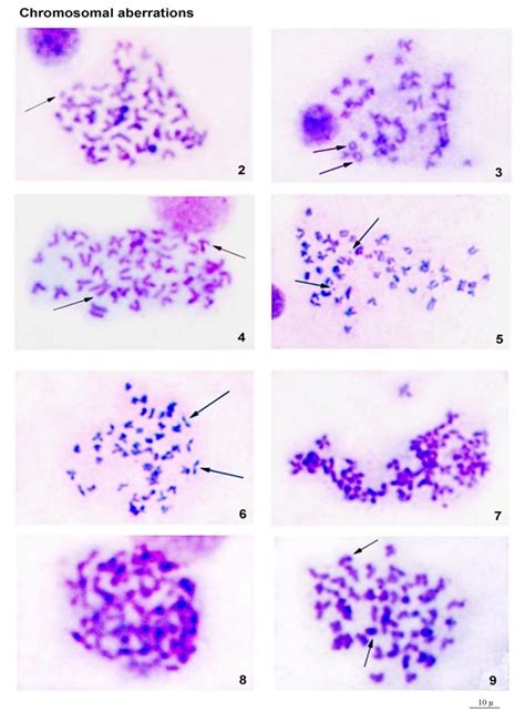 Chromosomal aberrations: Cf= Chromosome fragmentation (Fig. 2), Rc ...