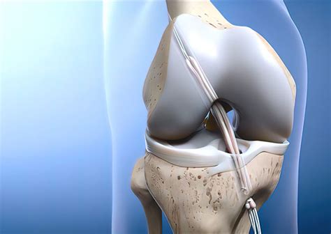 ACL Reconstruction - Medidocs - Best Medical Emergency Services in ...